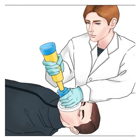 চোকিং ডিভাইস (শিশুর গলায় কিছু আটকে গেলে বের করুন)